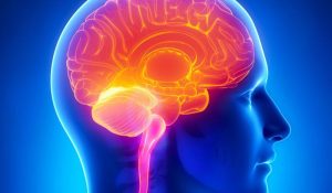 تدابیر بیماری ام اس MS