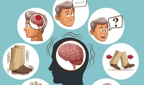 پارکینسون 