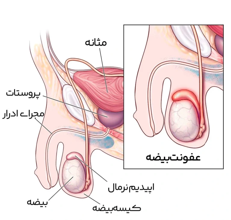 اپیدیدیمیت