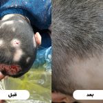 ریزش مو قبل و بعد درمان طب سنتی ریزش مو در دختر نوجوان