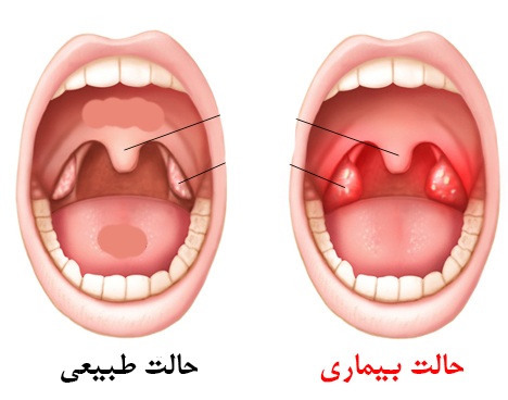 تل گیری