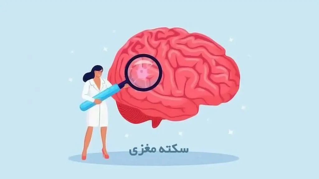 سکته مغزی