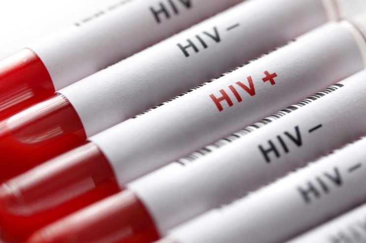 ایدز و HIV