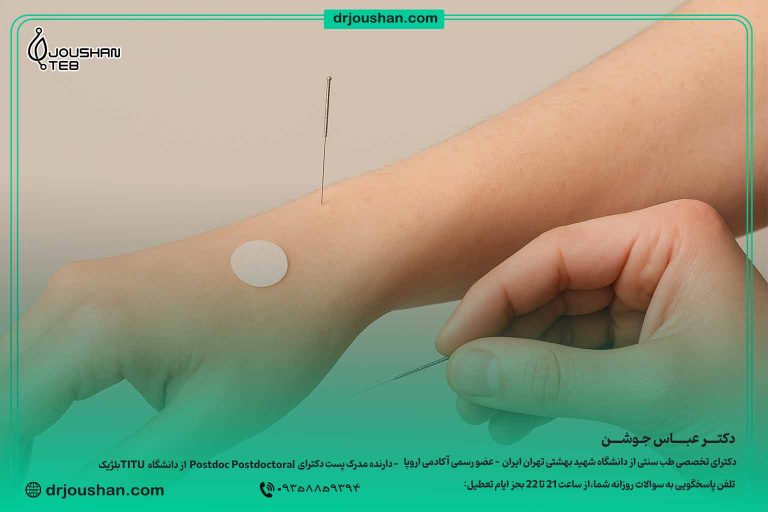  انواع-نقاط-طب-سوزنی
