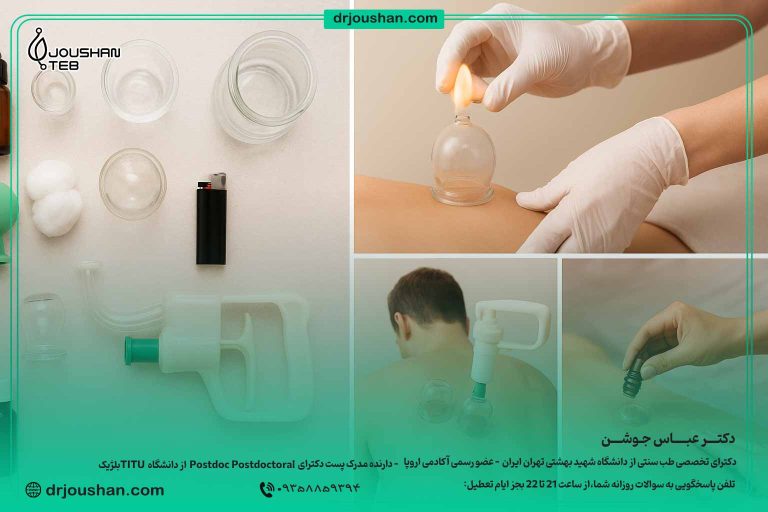 اجرای صحیح بادکش گرم و خشک باید ابزار مناسب