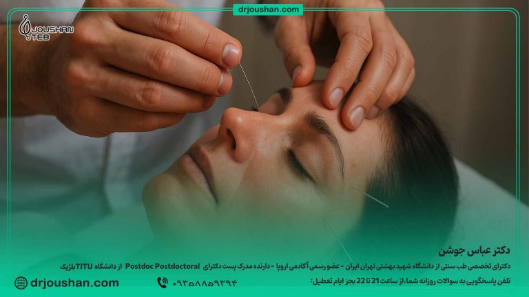 طب-سوزنی-و-سوزن‌زنی-مرسوم