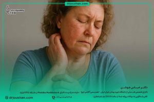 علائم-اگزما