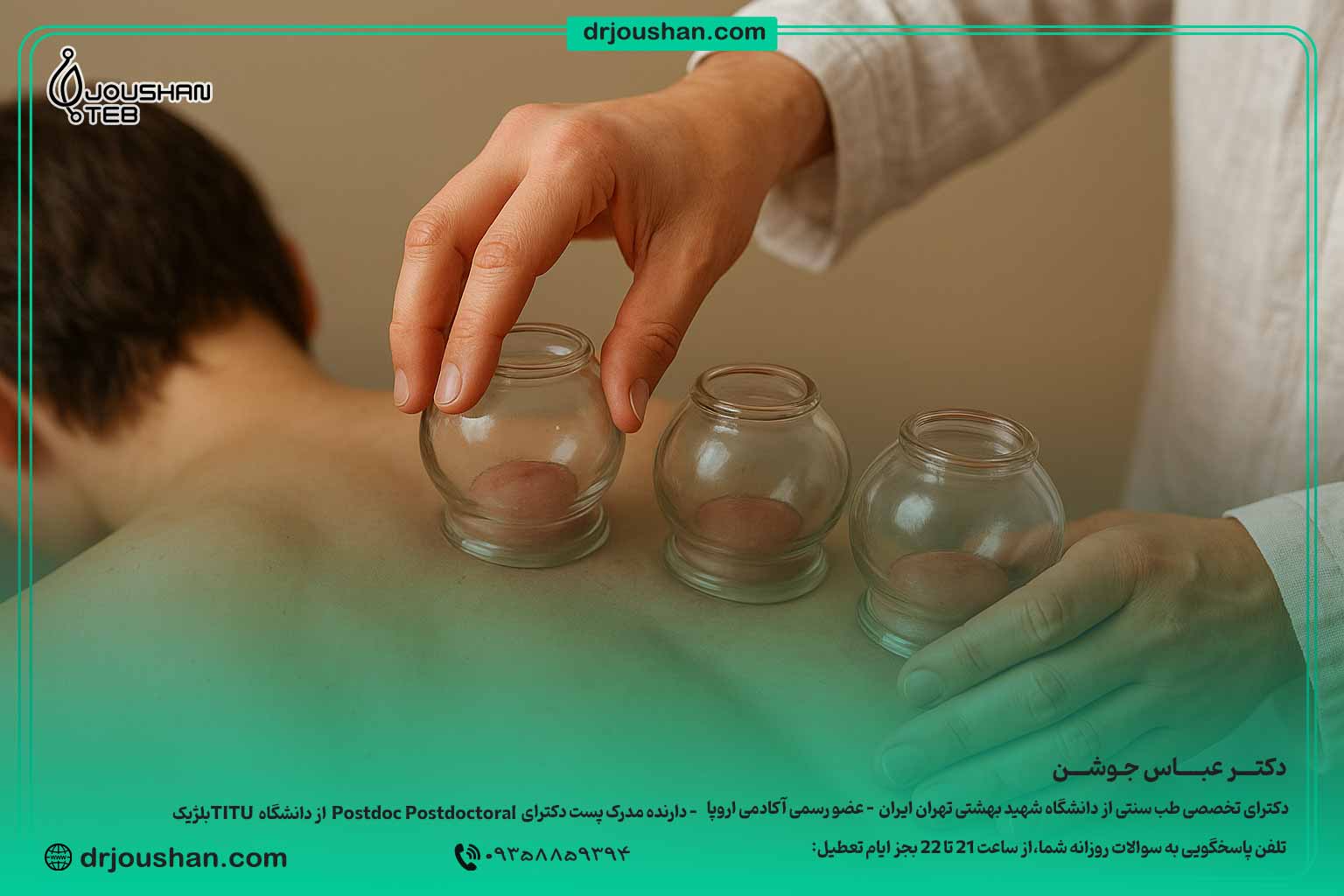 فواید-حجامت-برای-بدن