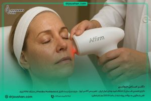 لیزر Affirm چیست