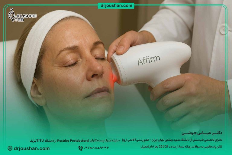 لیزر Affirm چیست