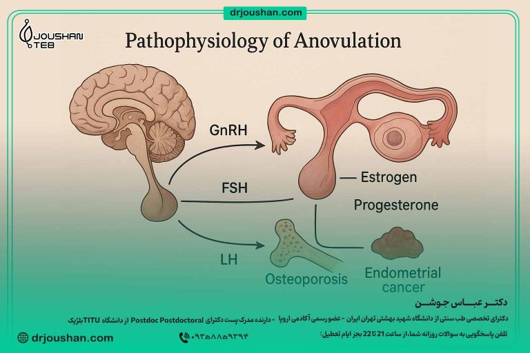 پاتوفیزیولوژی-عدم-تخمک‌گذاری