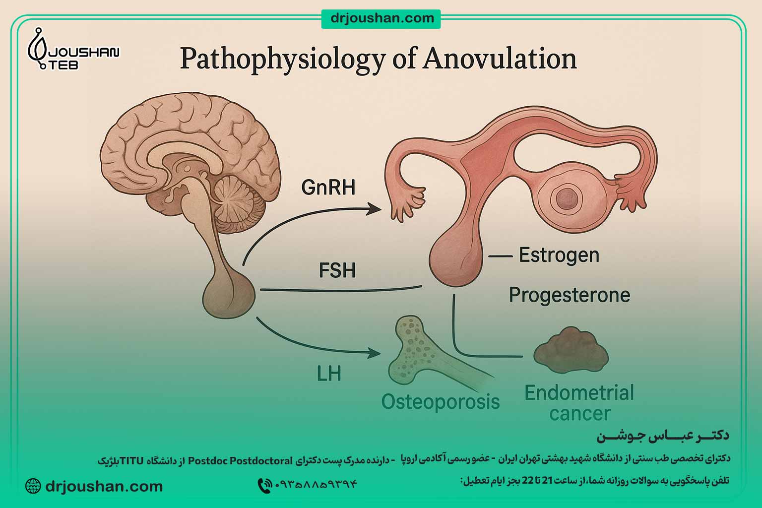 پاتوفیزیولوژی-عدم-تخمک‌گذاری