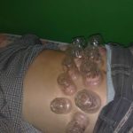 بادکش شب ادراری دکتر عباس جوشن