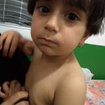 حجامت اطفال - دکتر عباس جوشن