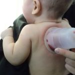 حجامت اطفال - دکتر عباس جوشن