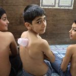حجامت نوجوان دکتر عباس حوشن