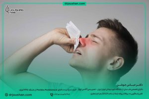 درمان-خون-دماغ