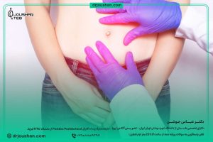 جا-افتادن-ناف،-افتادگی-ناف-یا-جابجایی-ناف