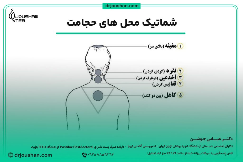 محل دقیق حجامت سر
