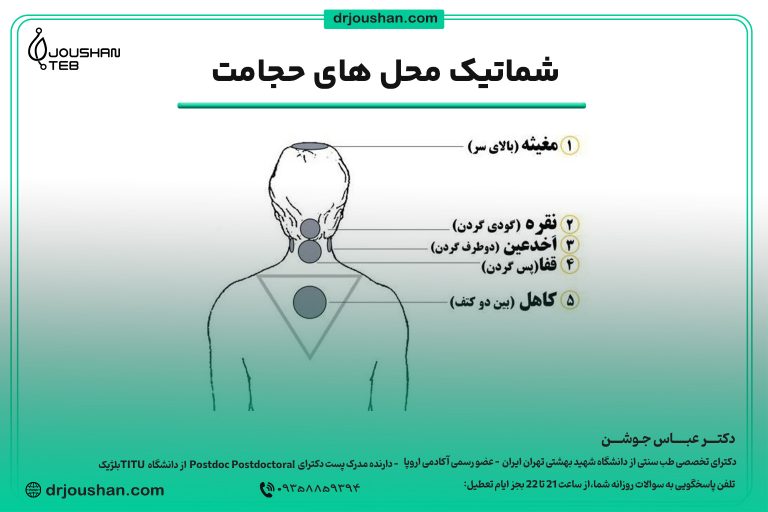 محل های دقیق حجامت سر