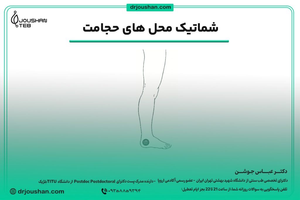 محل حجامت قوزک پا (زیر قوزک داخلی)