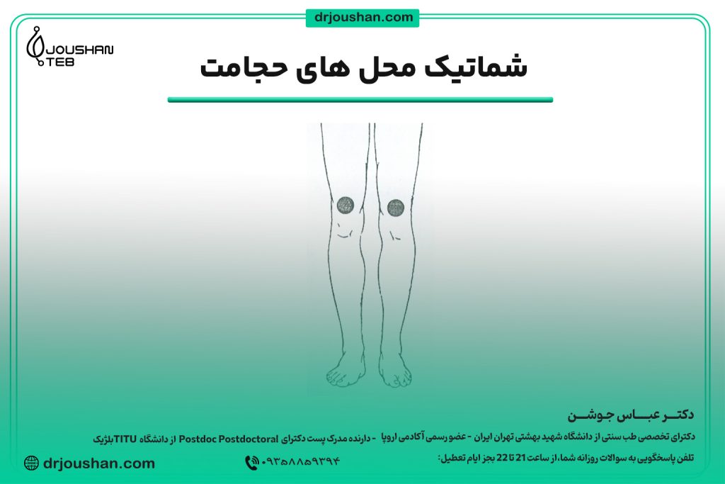محل حجامت بالای زانو از جلو