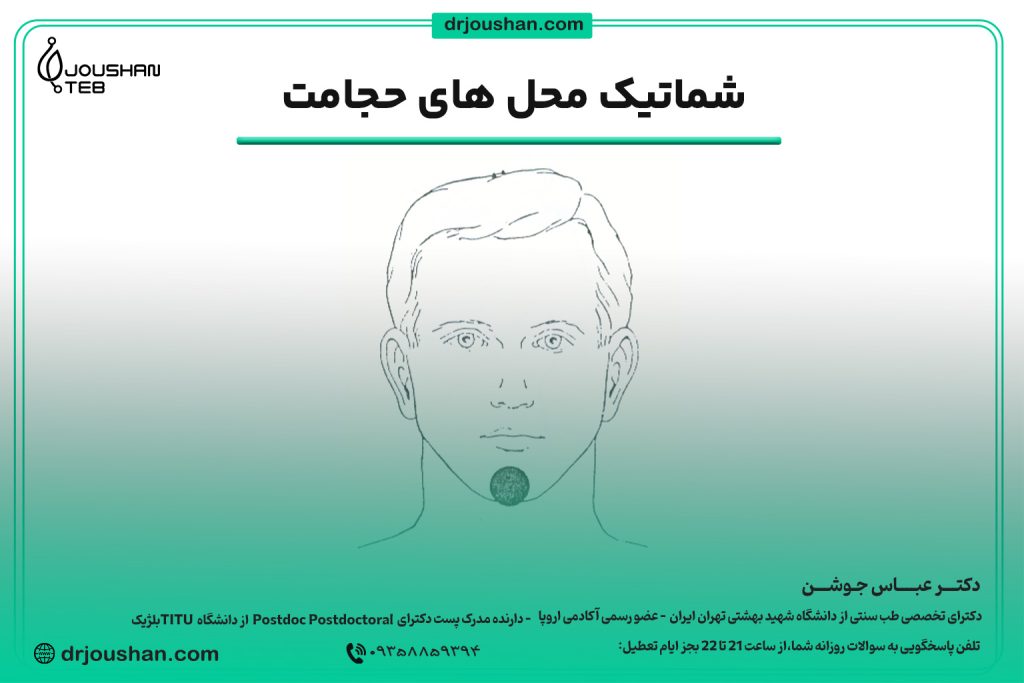 محل حجامت چانه