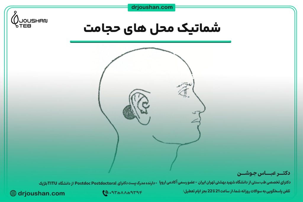 محل حجامت پشت گوش