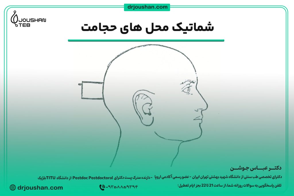 محل حجامت پشت سر جمجمه