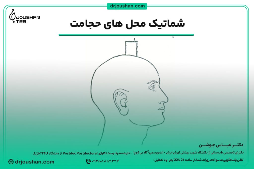 محل حجامت بالای سر جمجمه