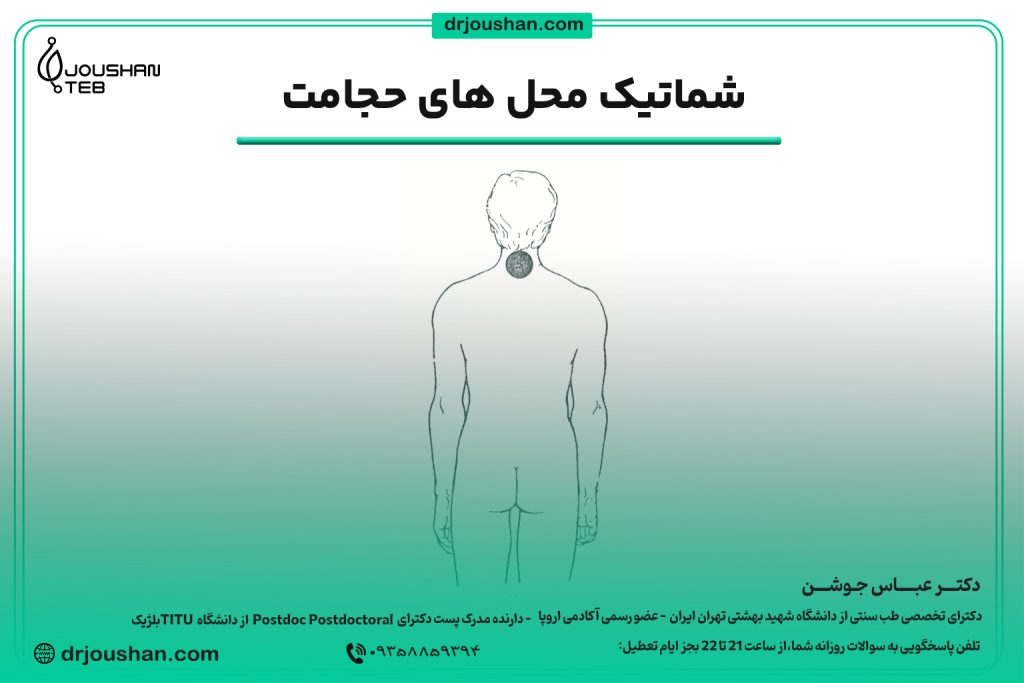 محل حجامت پشت گردن