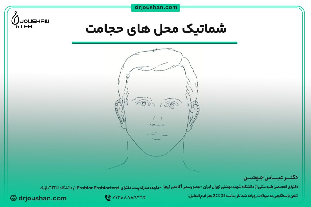محل حجامت لاله گوش