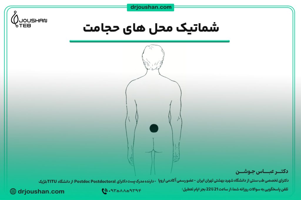 محل حجامت گودی کمر