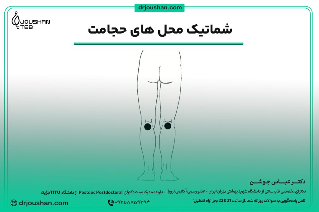 محل حجامت پشت زانو