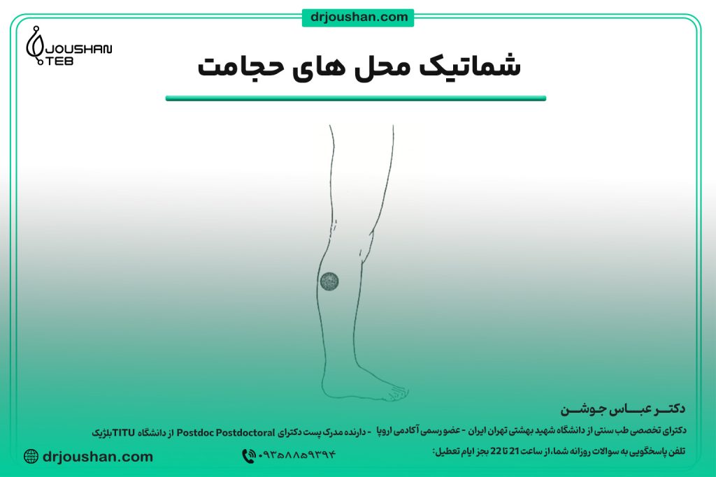 محل حجامت عضله ساق پا