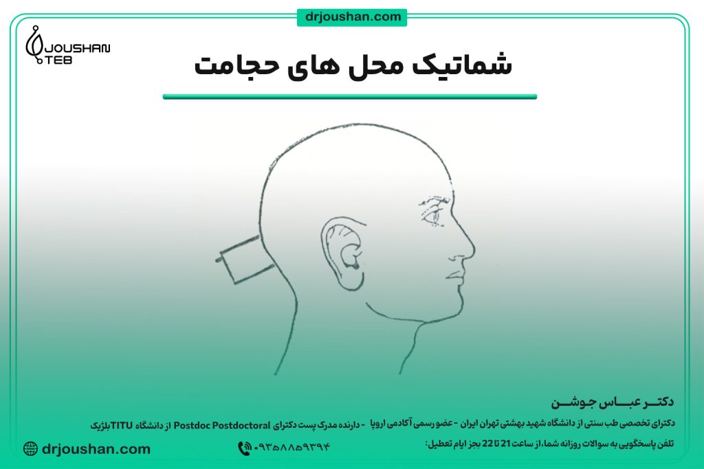 محل حجامت پشت سر جمجمه