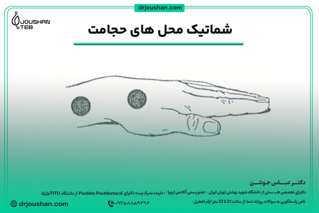 محل حجامت روی مچ دست