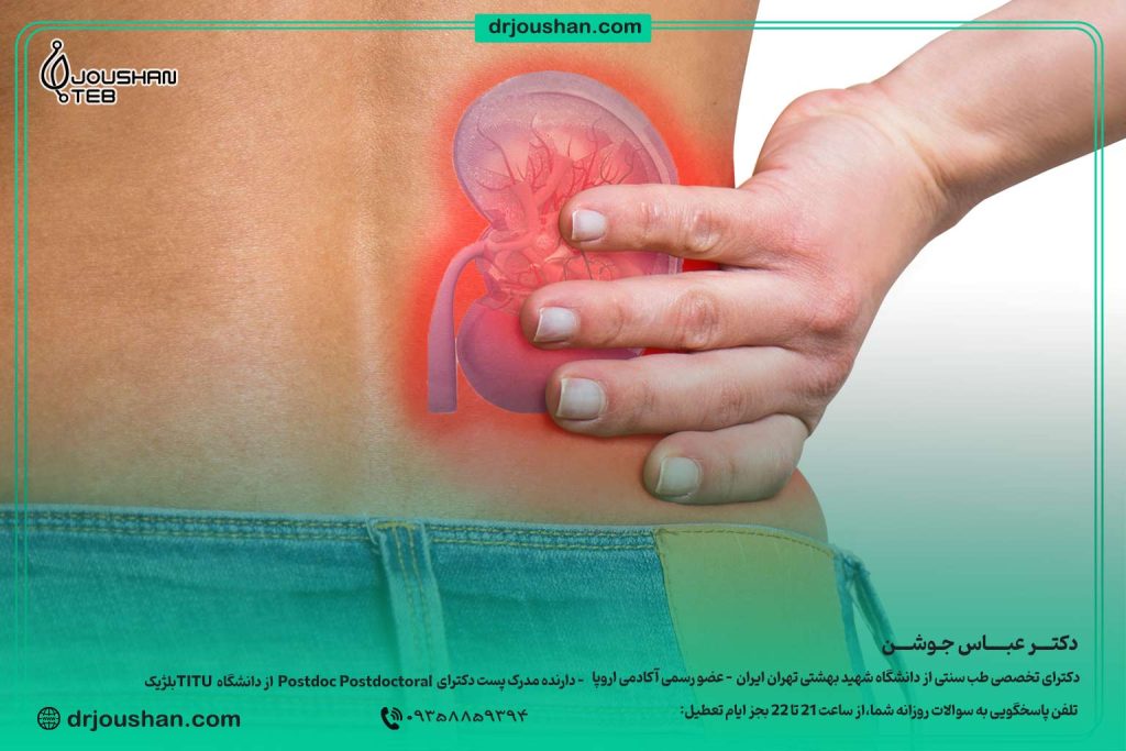 درمان-سنگ-کلیه-کوچک-شن-ریزه-در-طب-سنتی