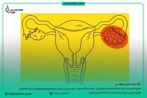 درمان-لکه‌-بینی-با-تنظیم-خواب