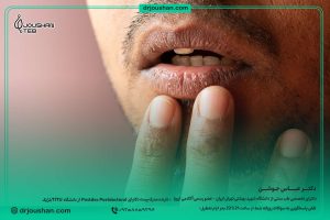 با-خشکی-دهان-صبحگاهی-چه-کنیم