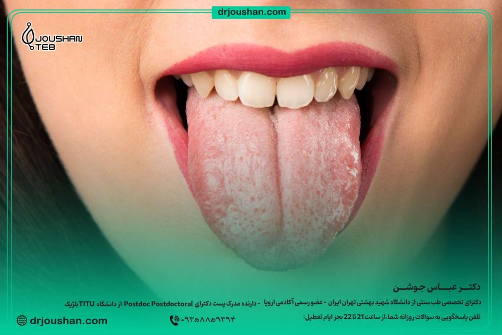 با-خشکی-دهان-و-عطش چه کنیم