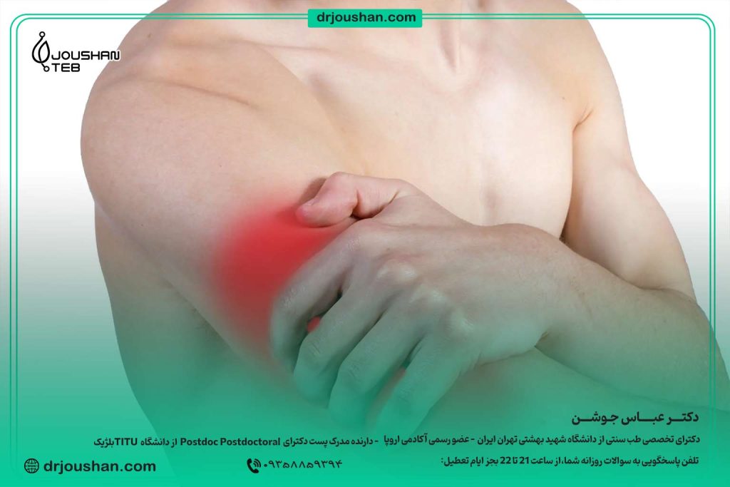 درمان-گرفتگی-عضلات