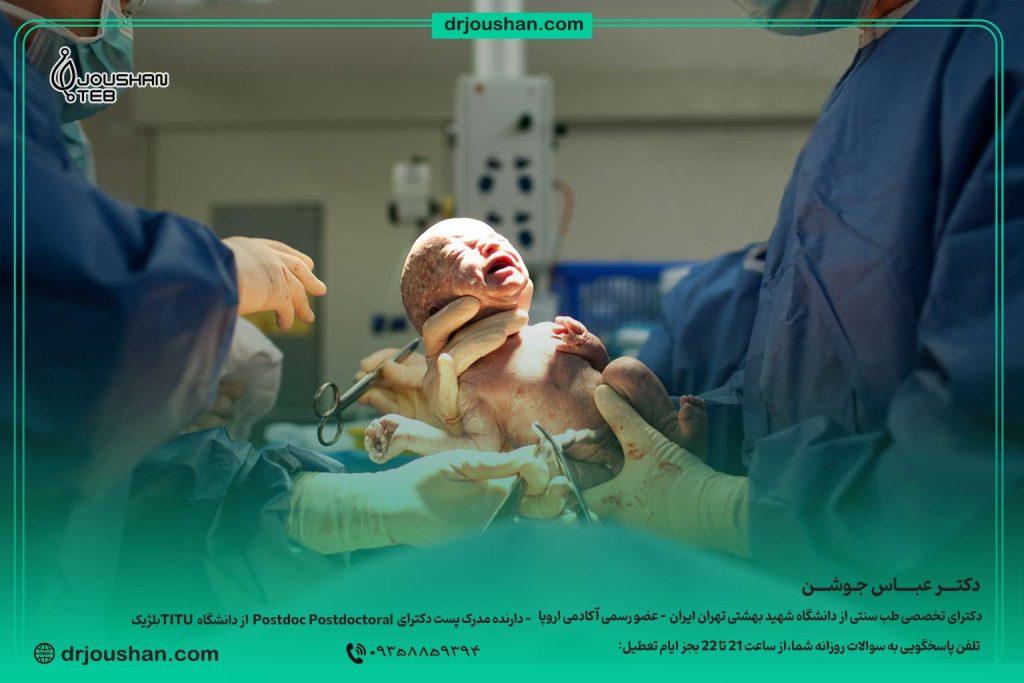 زایمان-سزارین-بهتره-یا-طبیعی؟-دکتر-عباس-جوشن
