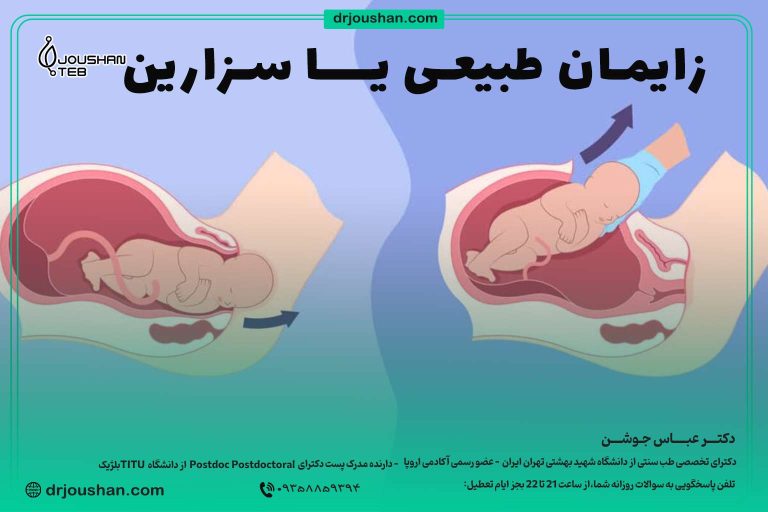 زایمان-طبیعی-یا-سزارین-دکتر-عباس-جوشن