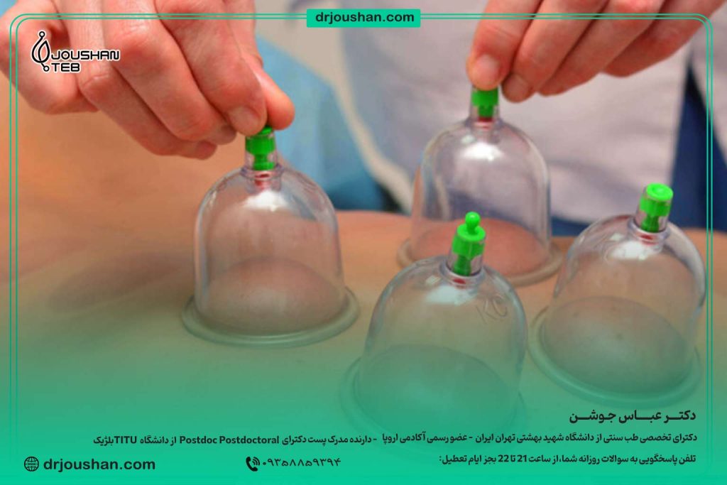 فواید-بادکش-برای-زنان-و-سردی-بدن