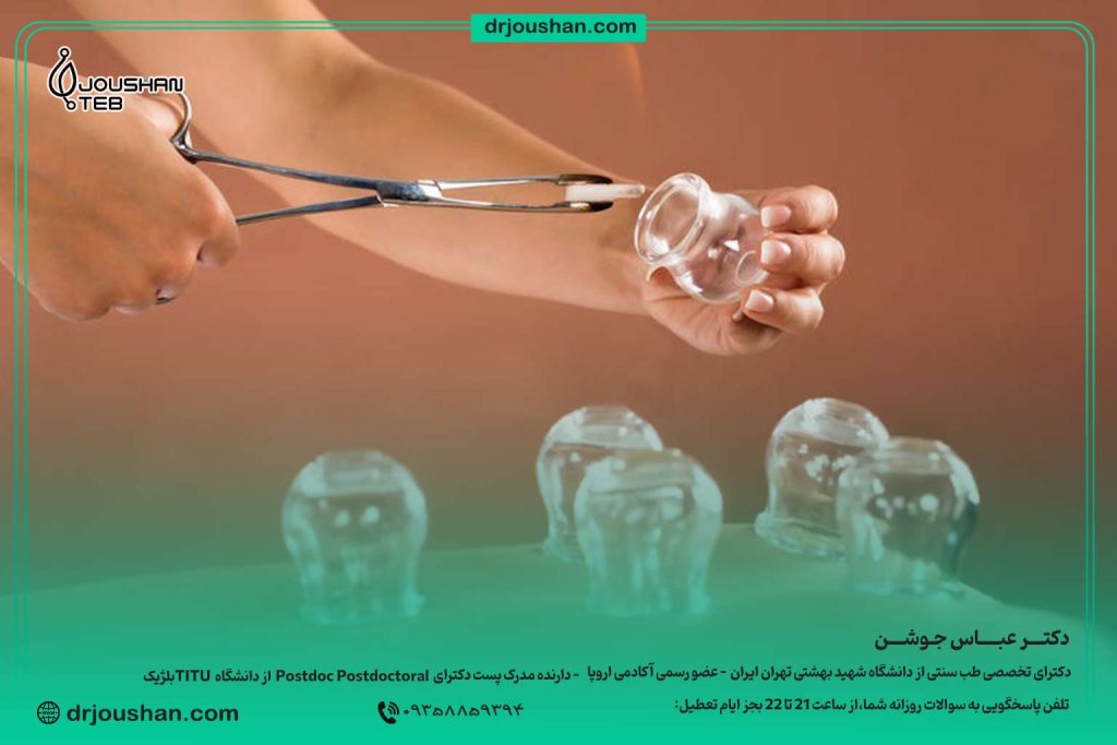 فواید-بادکش-در-طب-سنتی
