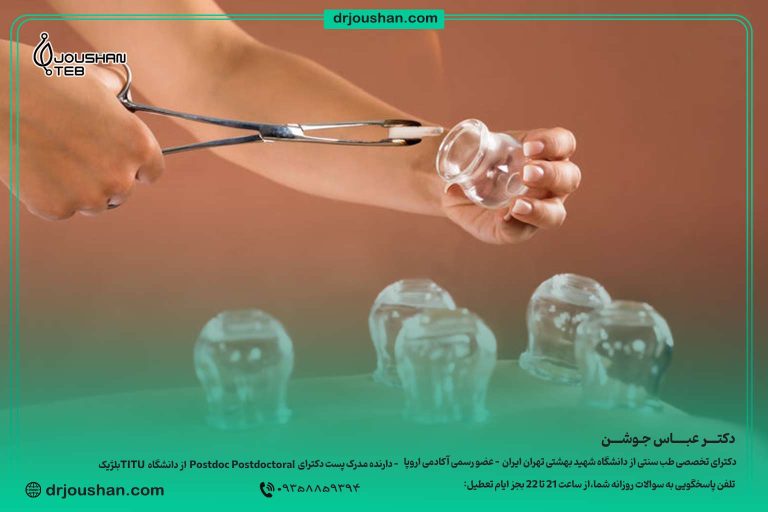 فواید-بادکش-در-طب-سنتی