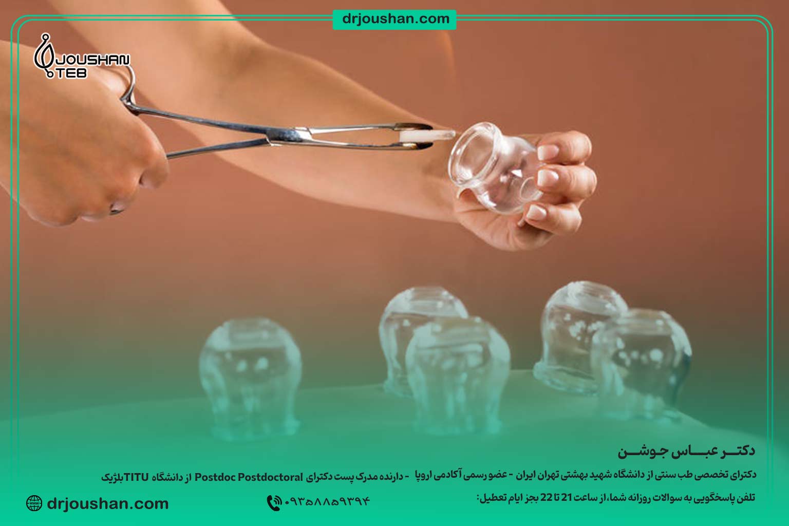 فواید-بادکش-در-طب-سنتی