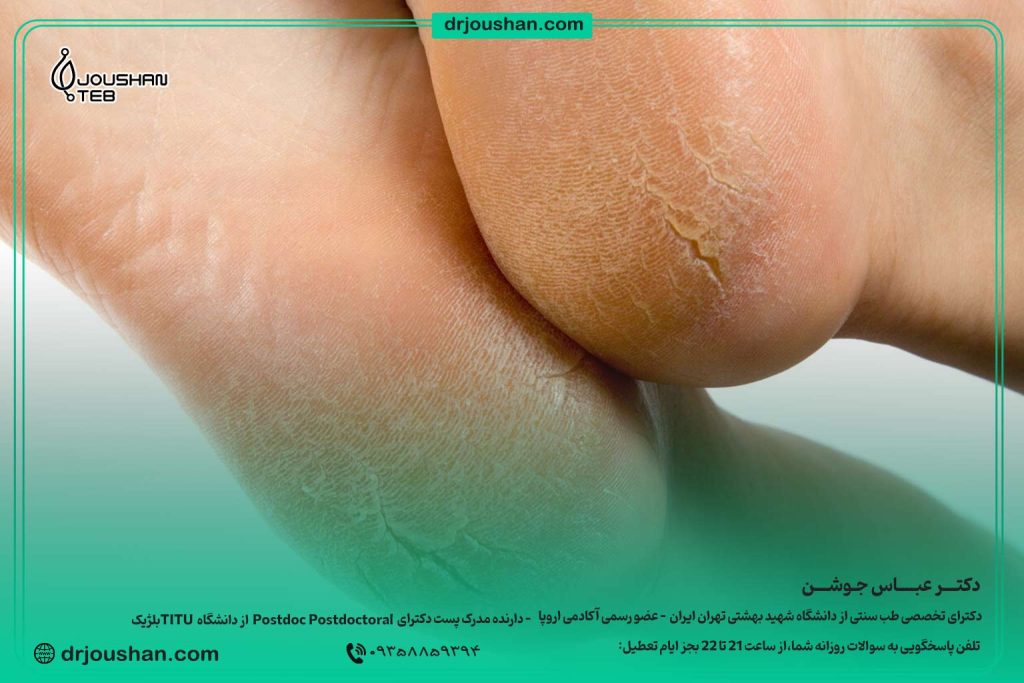 با-ترک-پاشنه-چکار-کنیم-دکتر-عباس-جوشن