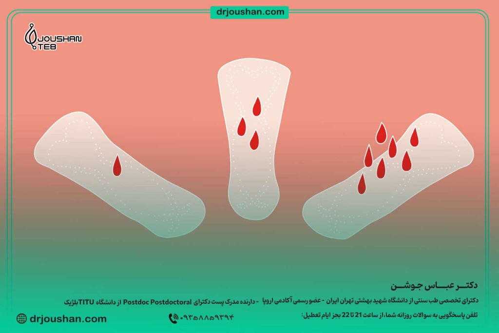 تفاوت-لکه-بینی-و-قاعدگی(پریود)-دکتر-عباس-جوشن
